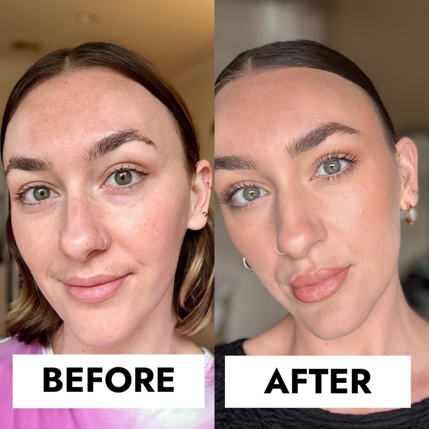 ELLIRA-SkinMorph™